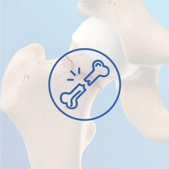 Fractures and Trauma