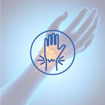 Carpal Tunnel Syndrome