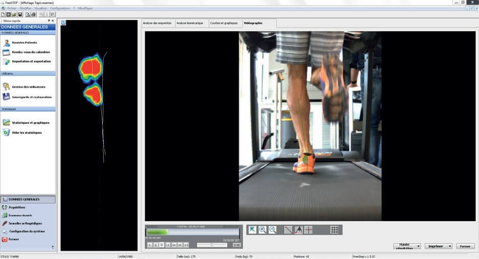 treadmill running sensor