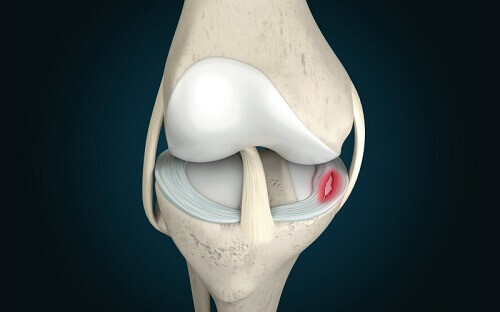 Meniscus tear Abu Dhabi