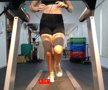 4-dimensional Gait Analysis System Abu Dhabi 4-dimensional Gait Analysis System Abu Dhabi