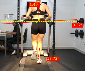4 -dimensional Gait Analysis System 4 -dimensional Gait Analysis System