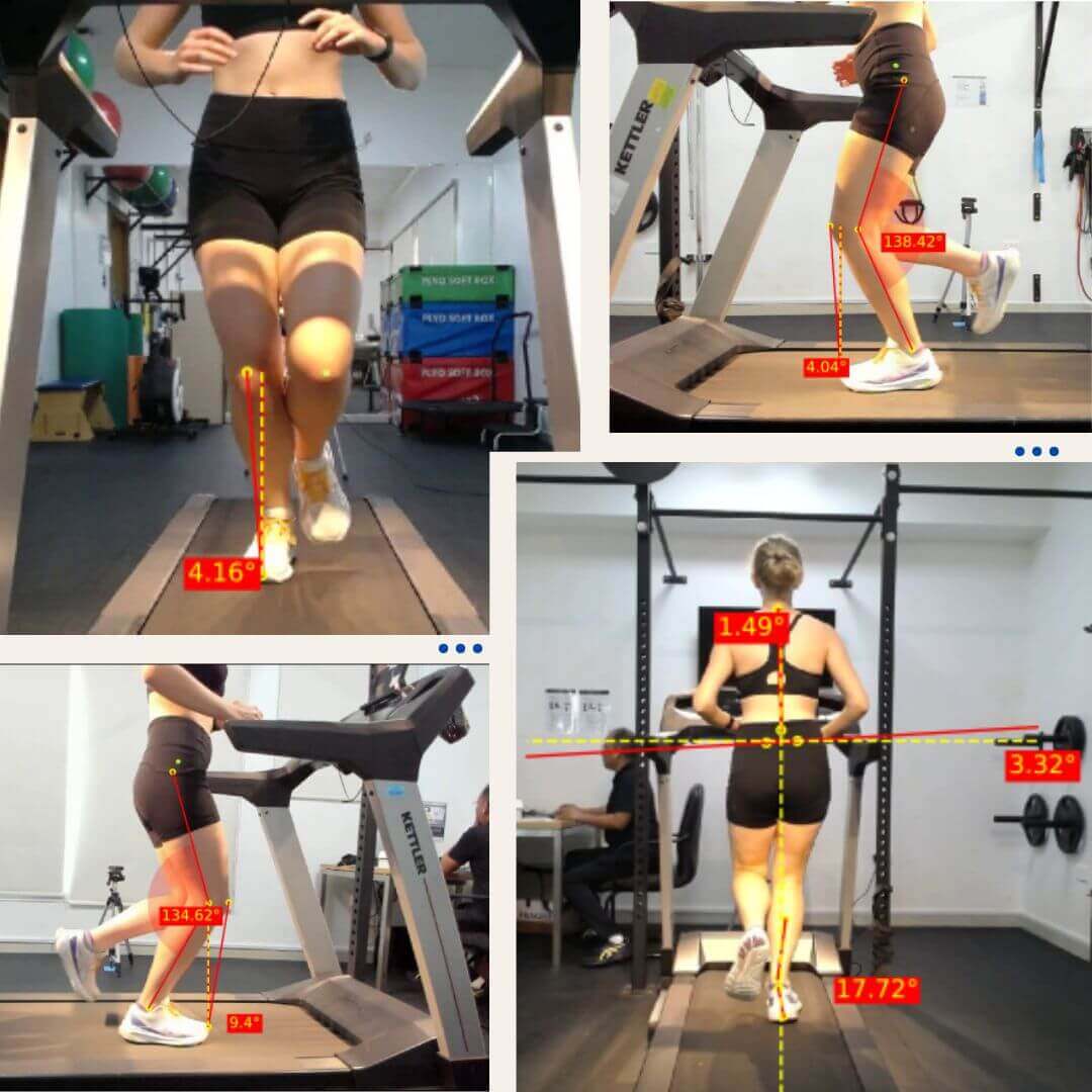 4-dimensional Gait Analysis System 4-dimensional Gait Analysis System