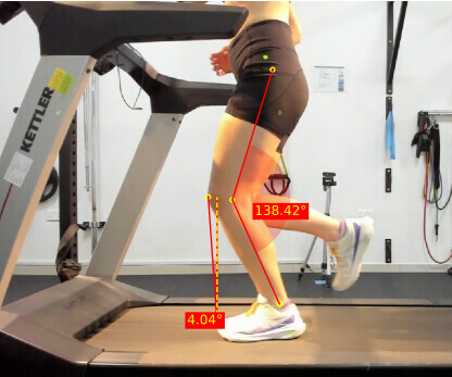 Gait Analysis Abu Dhabi Gait Analysis Abu Dhabi