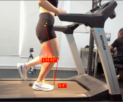 Video Gait Analysis Video Gait Analysis
