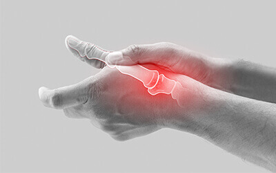 Arthritis Treatment of Thumb